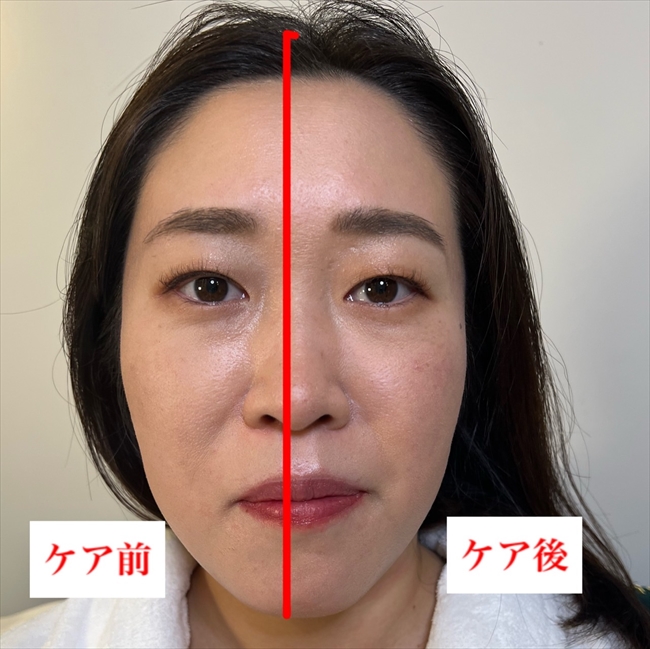 face_care_img02